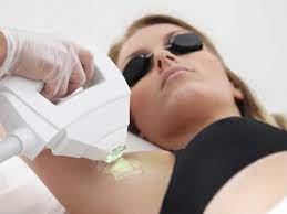 DÉPILATION LUMIÈERE PULSÉE